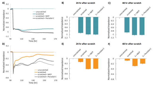 Monitoring Migration of Breast Cancer Cells using Maestro Z Real